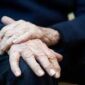 Parkinson 