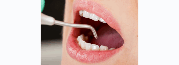 Lidah Tajam, Jantung Terguncang: Hubungan Tak Terduga antara Mulut dan Kesehatan Jantung