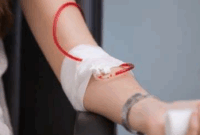 Thalassemia